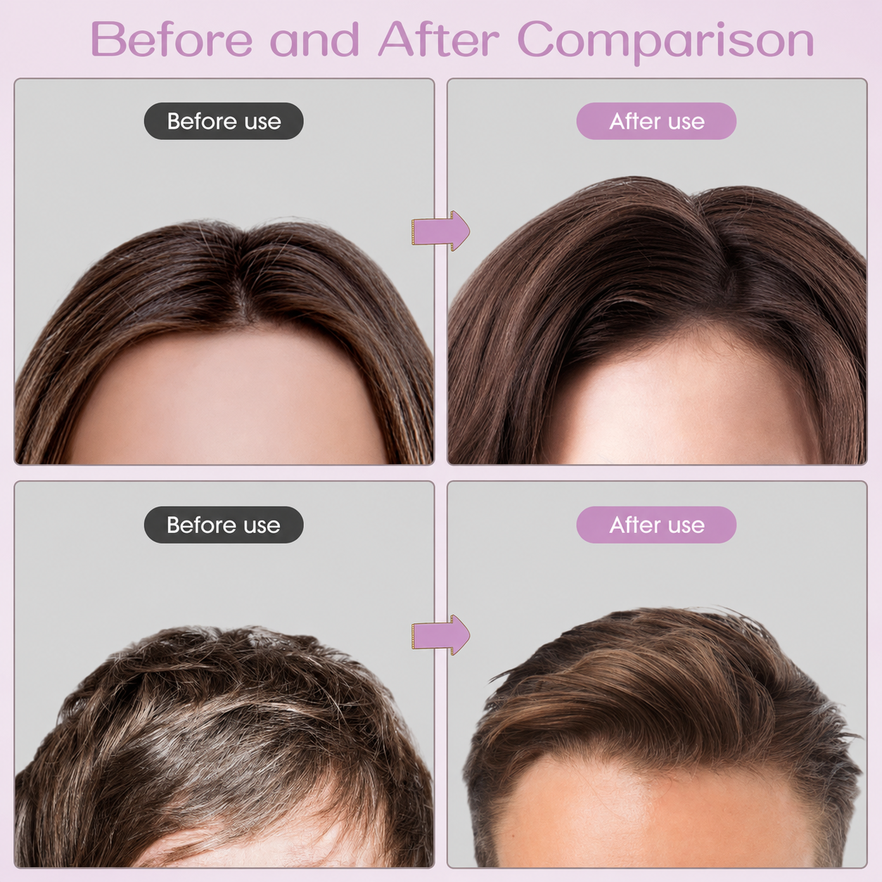 Hair Volumizing Clip